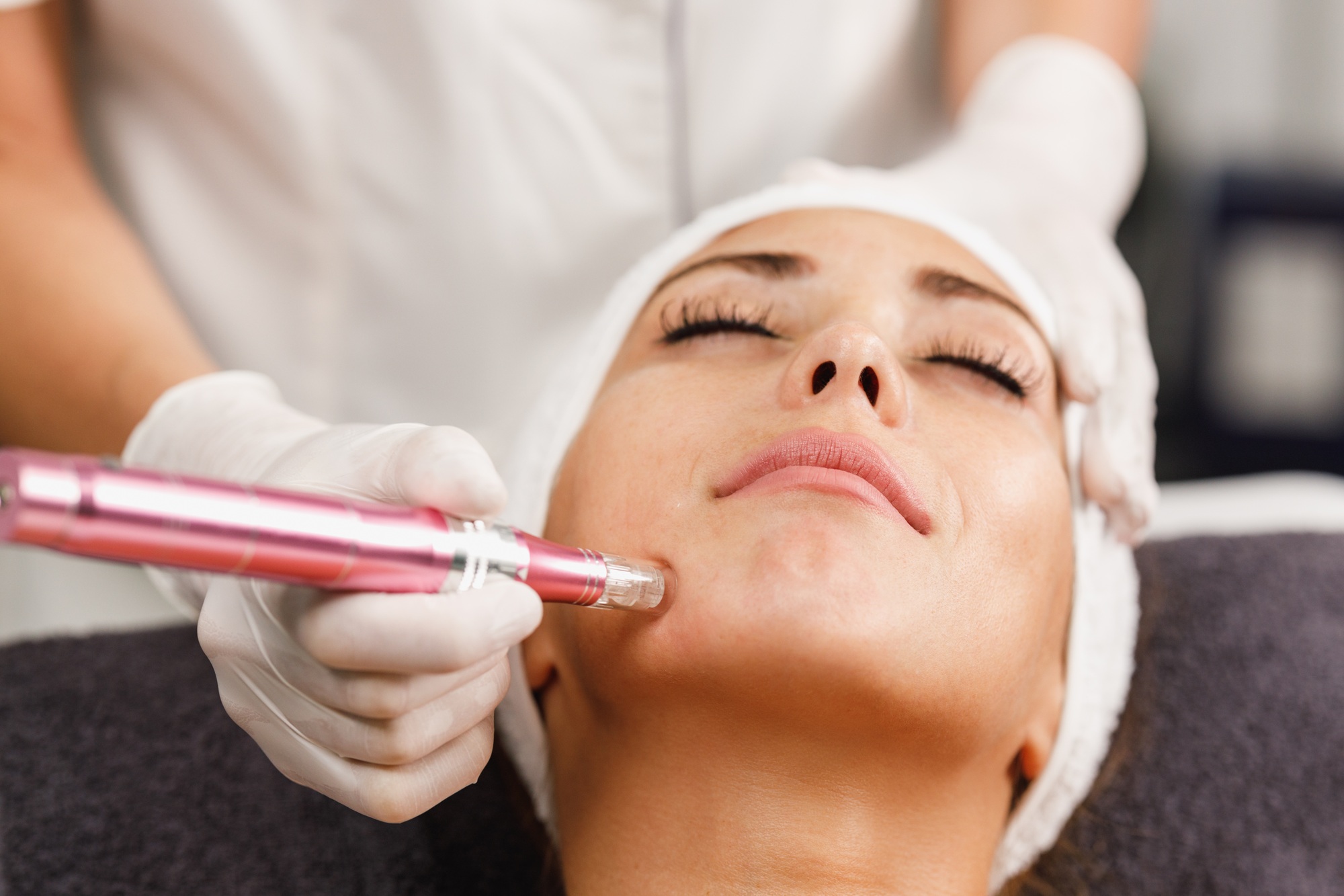 Dermapen Treatment In A Beauty Salon